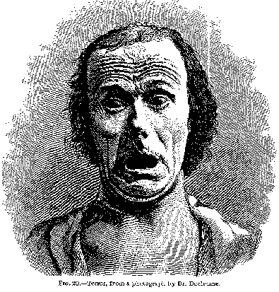 Fig. 20. -- Terror, from a photograph by Dr. Duchenne
