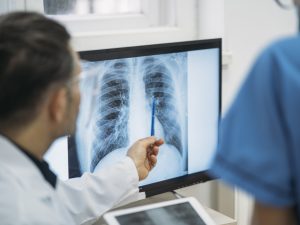 Close-up of two medical professionals looking at an x-ray of a the lungs and ribs.