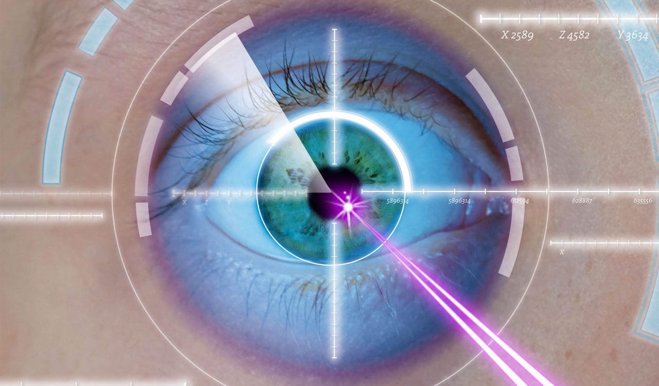 An eye is shown under lasers.