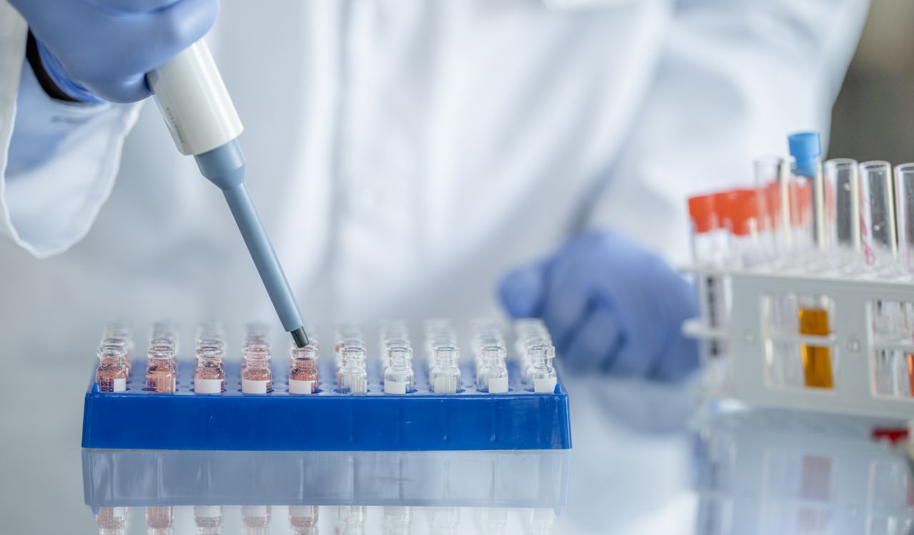 A close-up view of hands in blue medical gloves holding lab during a lab test.