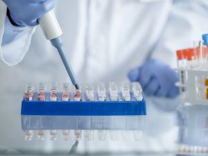 A close-up view of hands in blue medical gloves holding lab during a lab test.