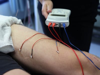 BSM Clinic Acupuncture