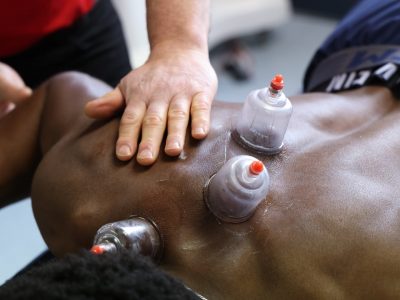 BSM Clinic Cupping